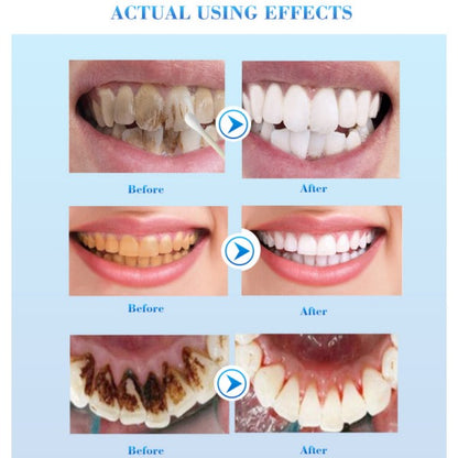 Efero Teeth Whitening Essence Liquid
