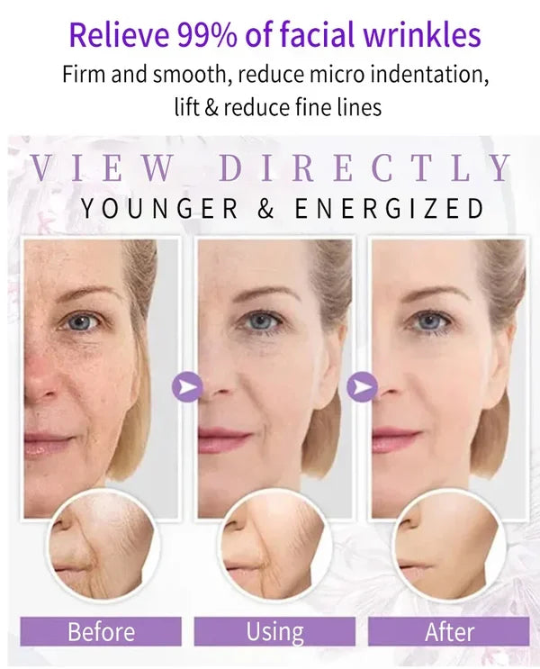 🎉Last Day Promotion - 49% OFF🎉Japanese Anti-wrinkle Rejuvenation Cream