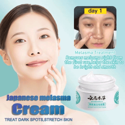 🔥BUY 1 GET 1 (2PCS)🔥 - 🌿Yunnan Herbal Whitening and Freckle-Removing Cream