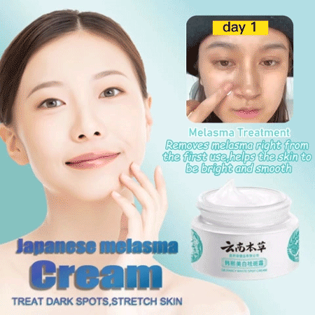 🔥BUY 1 GET 1 (2PCS)🔥 - 🌿Yunnan Herbal Whitening and Freckle-Removing Cream