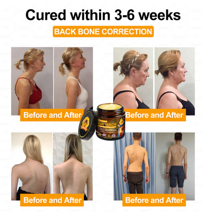 ✅Official Store: Bee-Venom Pain-Relief Bone Healing Cream✅( BOA Approved)(🔥𝑳𝒂𝒔𝒕 𝒅𝒂𝒚 𝒑𝒓𝒐𝒎𝒐𝒕𝒊𝒐𝒏 50% 𝒐𝒇𝒇)🍀