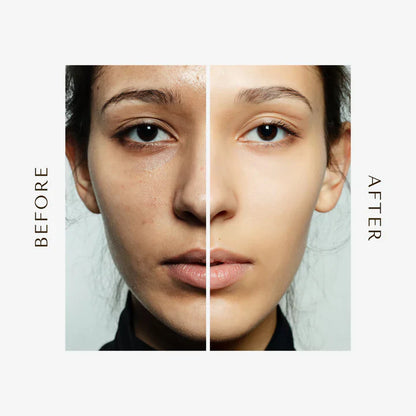 GLOW COMBO SET- 🔥Limited Time Exclusive Offer