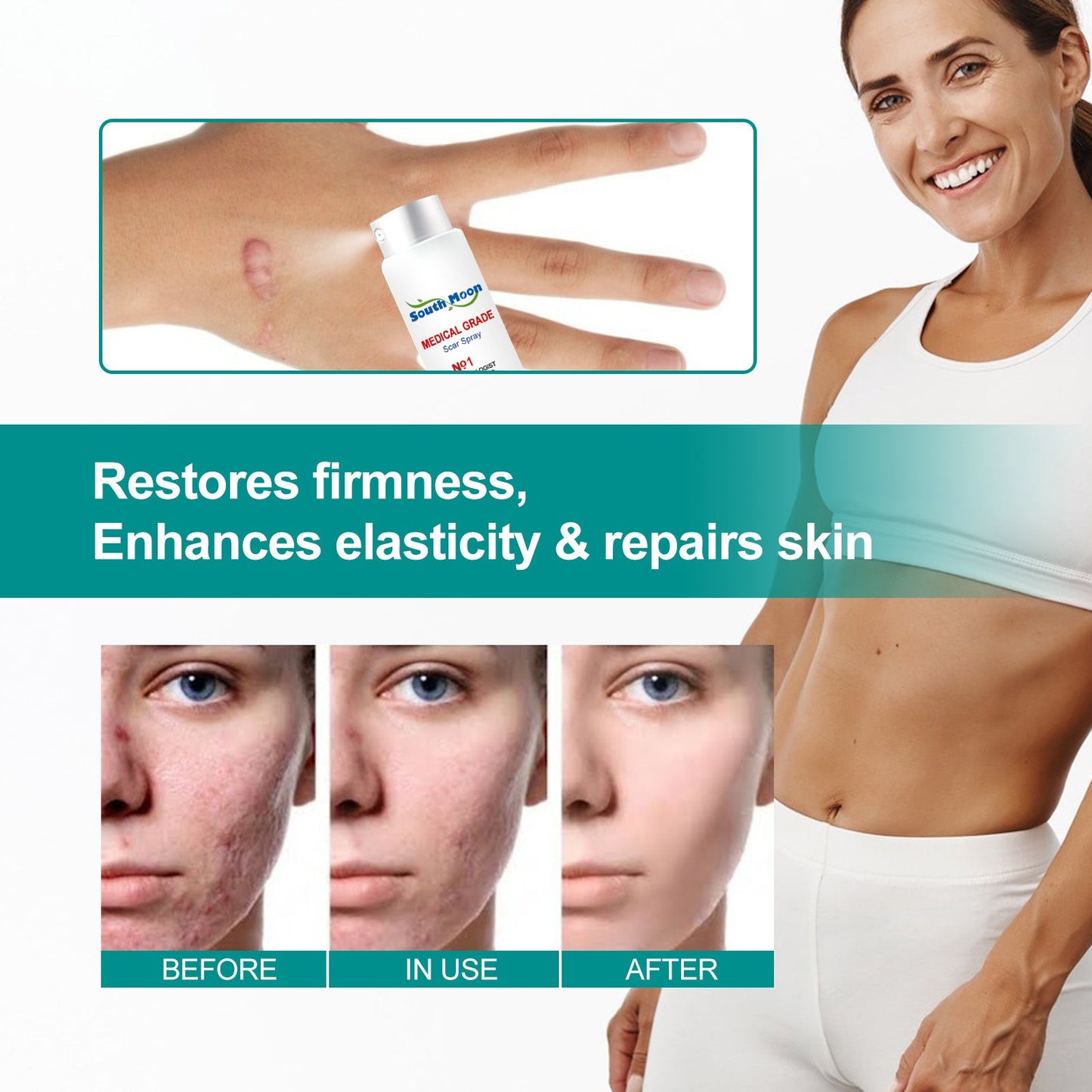 SCAR REMOVAL SPRAY