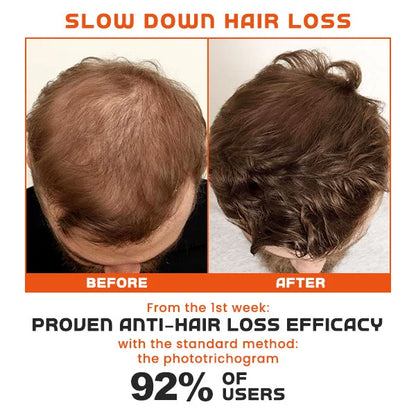 Re:ACT Minoxi Roll-On Conditioner