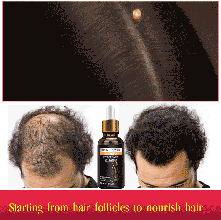 Hair growth essential oil