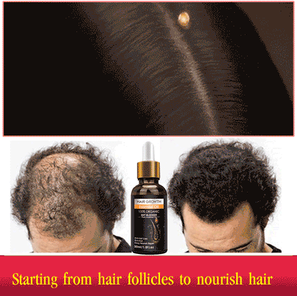 Hair growth essential oil
