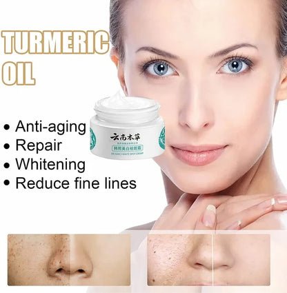 🔥BUY 1 GET 1 (2PCS)🔥 - 🌿Yunnan Herbal Whitening and Freckle-Removing Cream