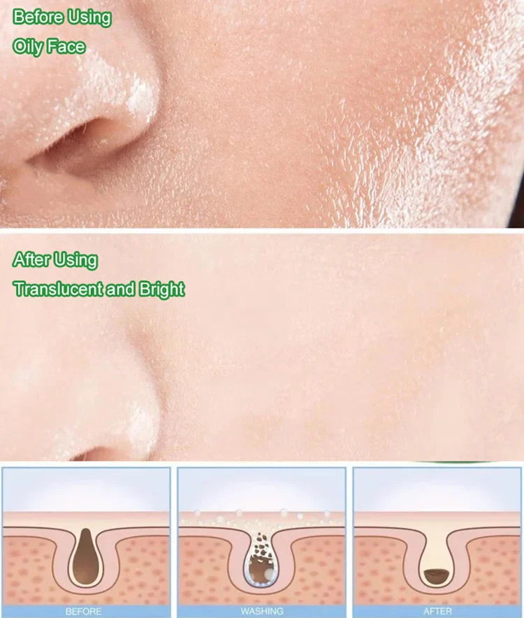 Green Tea Oil Control Facial Mask Stick-🔥🔥BUY 1 GET 1 FREE