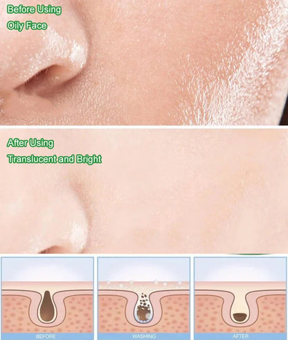 Green Tea Oil Control Facial Mask Stick-🔥🔥BUY 1 GET 1 FREE