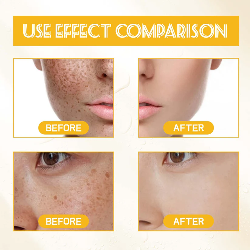 Whitening facial serum