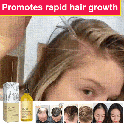 Natural Rosemary Hair Growth Essential Oil