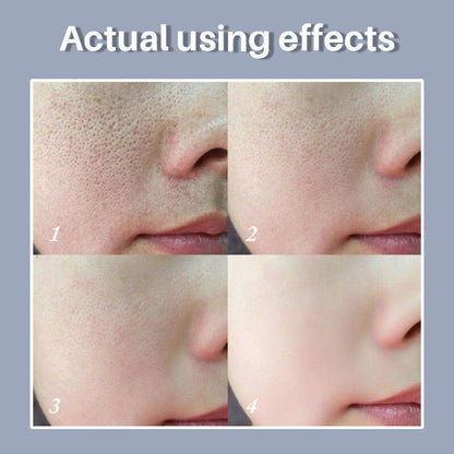 (💥Mothers Day Sale💥- 40% OFF) 2024 New Magical Pore Eraser Waterproof Face Primer Stick