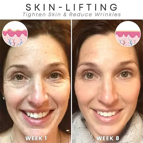 🔥Last Day 90% OFF-Niacinamide Facial Essence💖