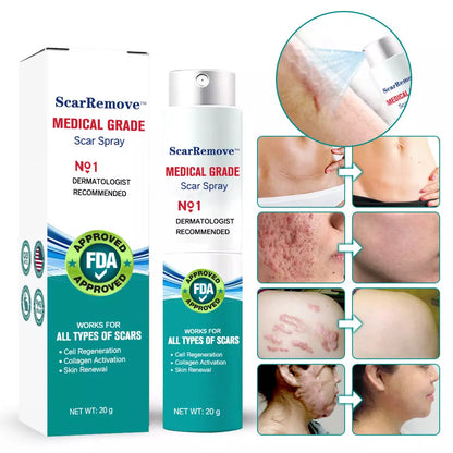 SCAR REMOVAL SPRAY