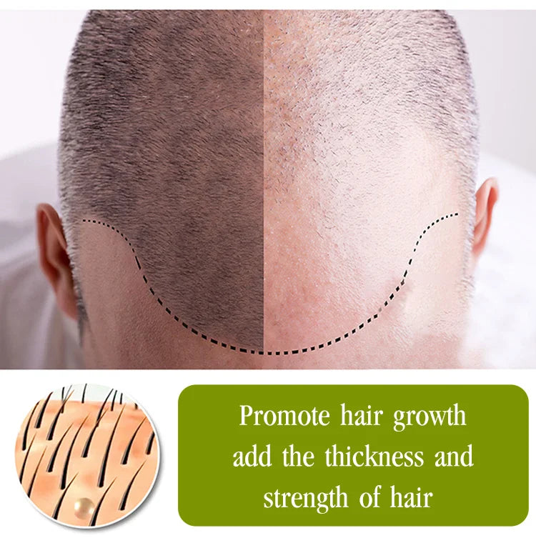 Hair growth essential oil