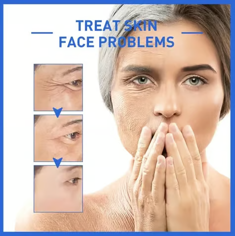 🔥Last Day 90% OFF-Niacinamide Facial Essence💖