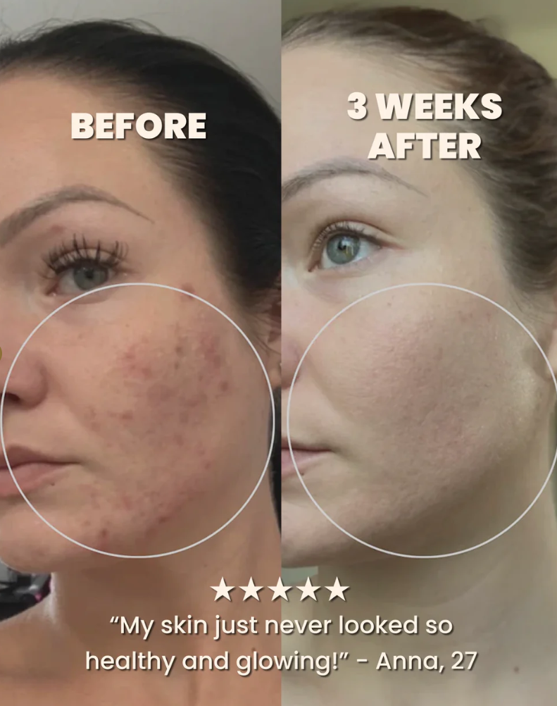 Panacelle Recovery Mud Mask