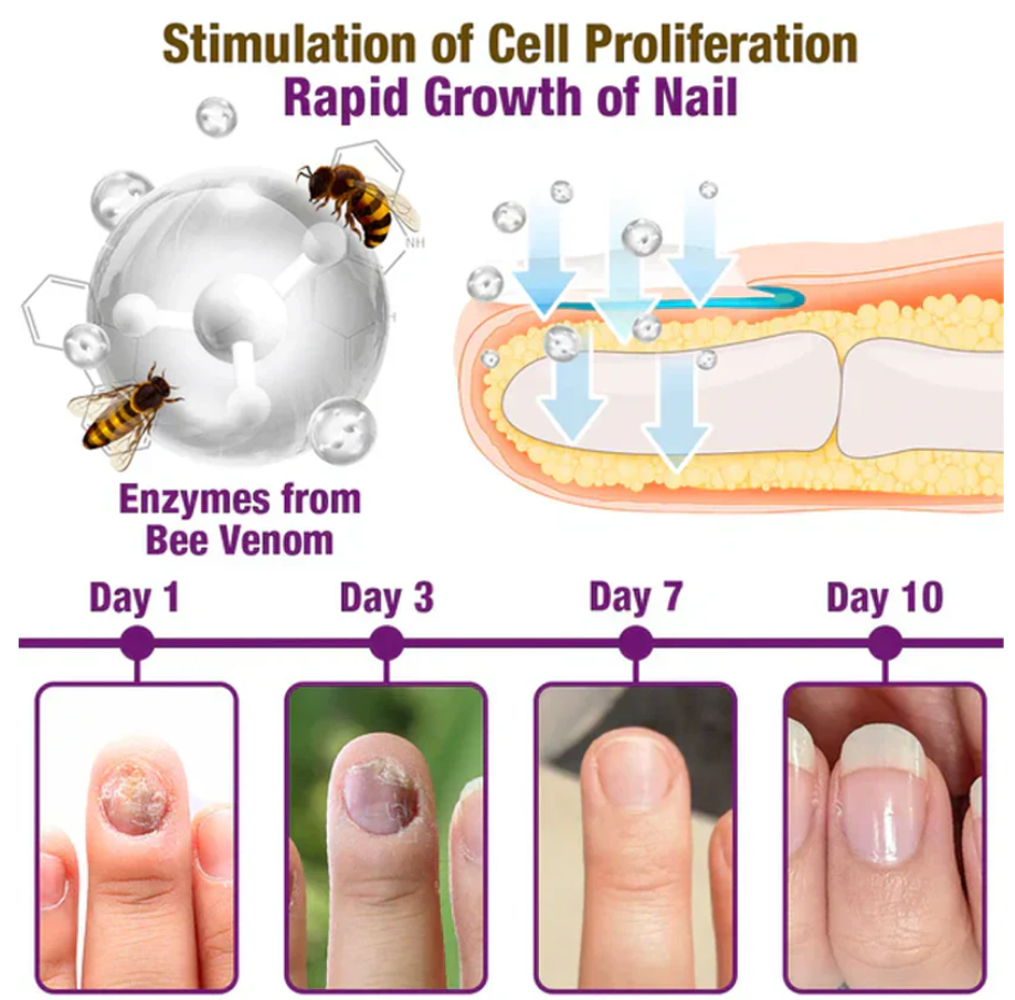 🐝BBOJI™ Fungus-Fres Bee poison Nail Treatment Serum