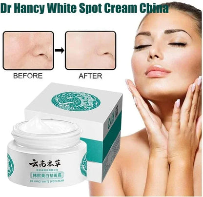 🔥BUY 1 GET 1 (2PCS)🔥 - 🌿Yunnan Herbal Whitening and Freckle-Removing Cream