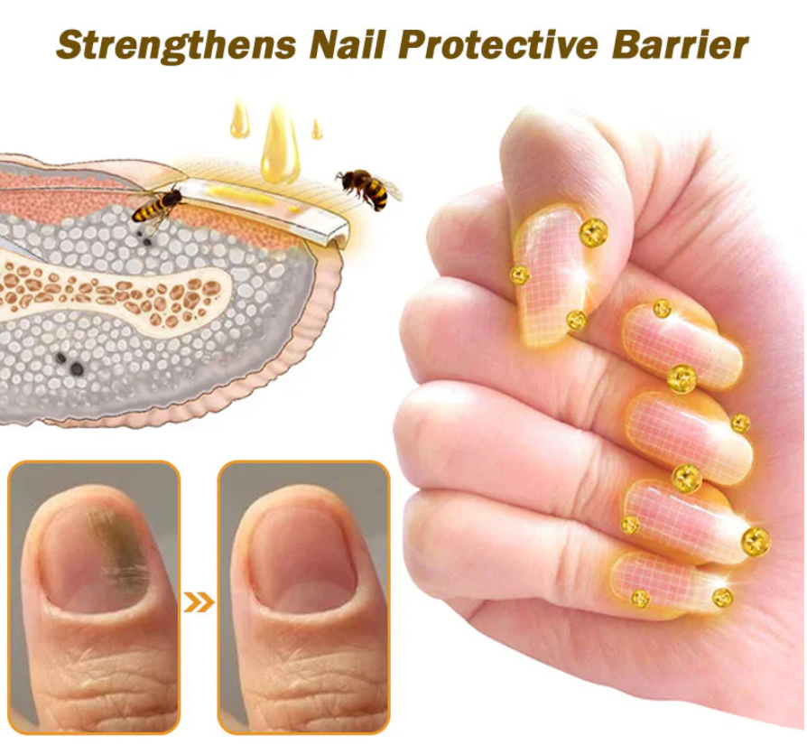 🐝BBOJI™ Fungus-Fres Bee poison Nail Treatment Serum