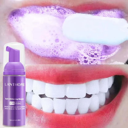 V34✨Bright Smile Saver Mousse Toothpaste