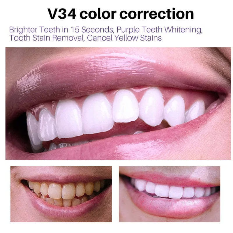 V34✨Bright Smile Saver Mousse Toothpaste