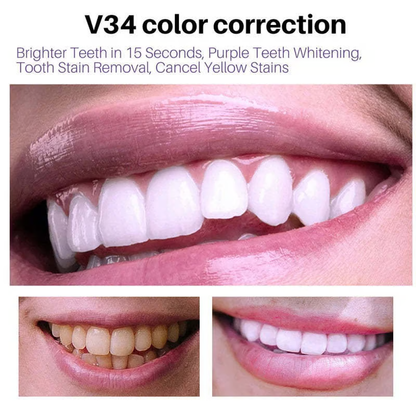 V34✨Bright Smile Saver Mousse Toothpaste