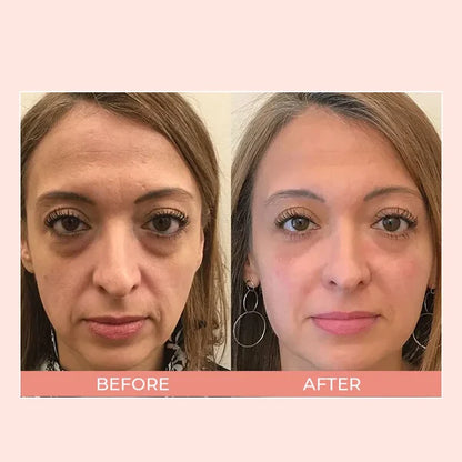 EIASER™ Retinol Polypeptide Repair Eye Cream