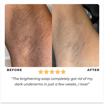 ✨The lowest price online $9.99💥Turmeric Brightening Soap