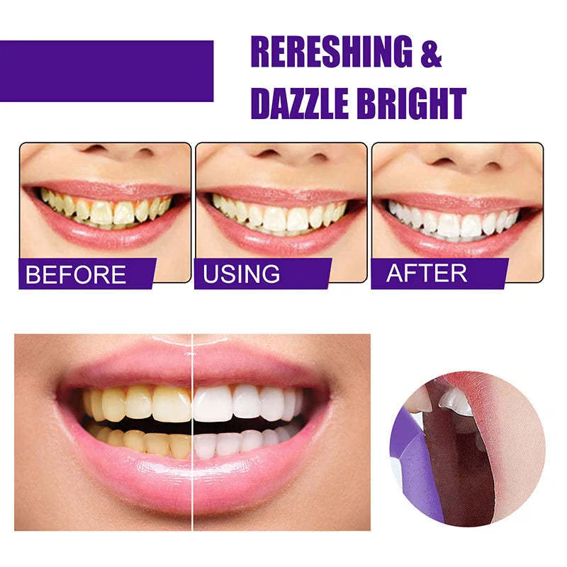 V34✨Bright Smile Saver Mousse Toothpaste