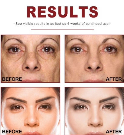 Jaysuing Retinol B3 Serum