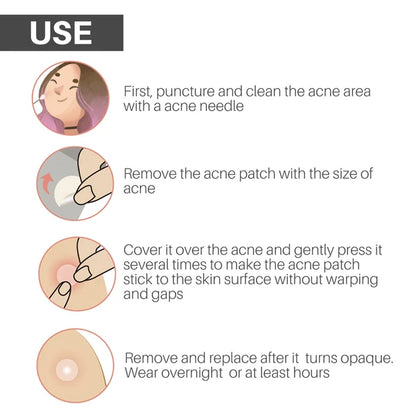 ✨ 2024 Hydrocolloid Acne Cover Patches（🔥Buy 3 Get 3 Free）