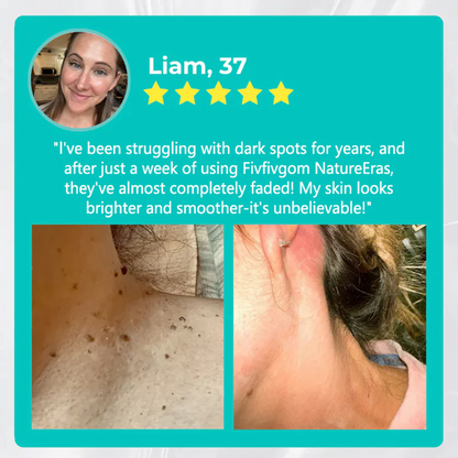 ✅Official Store: LOVILDS™ NatureErase Instant Mole & Spot Removal Gel