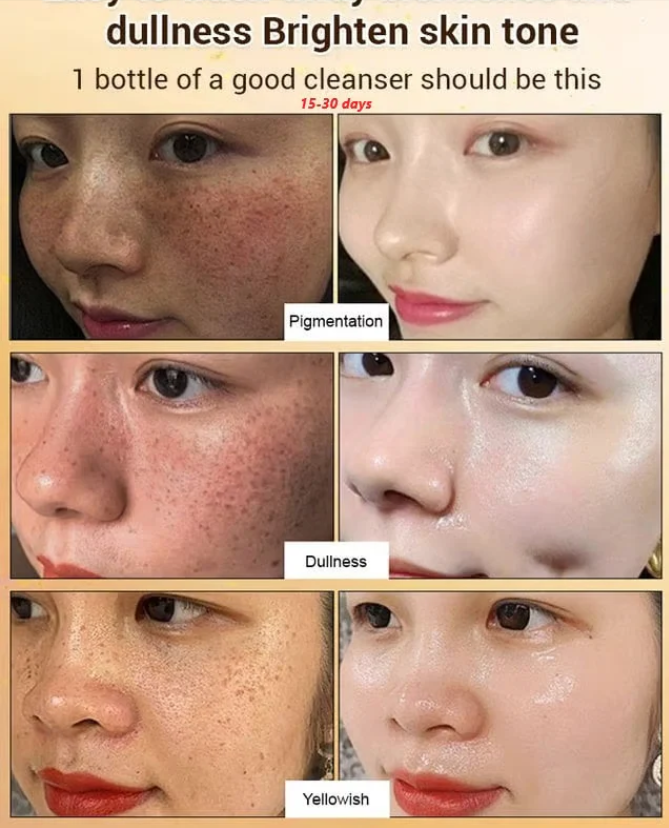 Upgraded anti-freckle essence oil