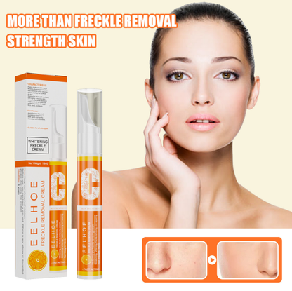 TripleAction Vitamin C Freckle Removal Cream