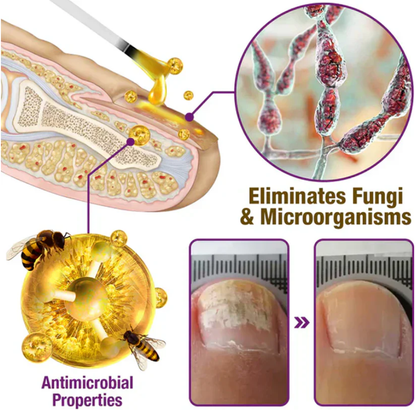 🐝BBOJI™ Fungus-Fres Bee poison Nail Treatment Serum